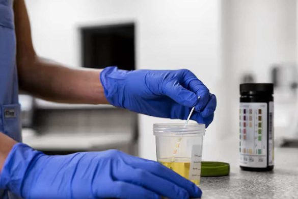 How Urine Cup Drug Tests Save Time and Money for Businesses